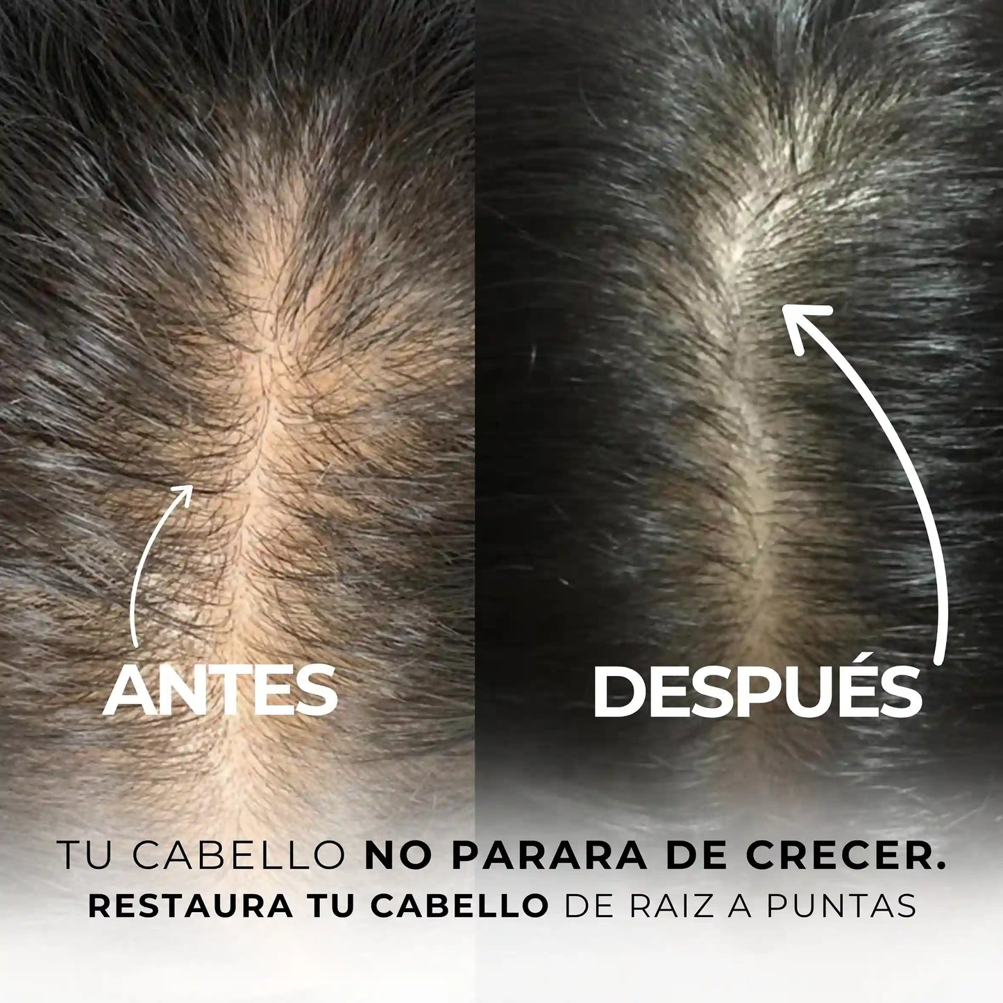 KIT BIOESTIMULADOR DE CRECIMIENTO + EBOOK